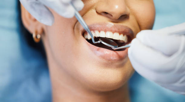 Best Broken or Cracked Tooth Emergency Dentist in Steubenville, OH