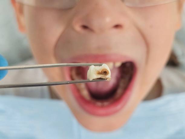 Best Emergency Cosmetic Dentistry in Steubenville, OH